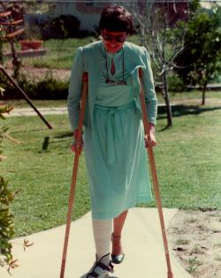 Helen Perl on crutches 1982