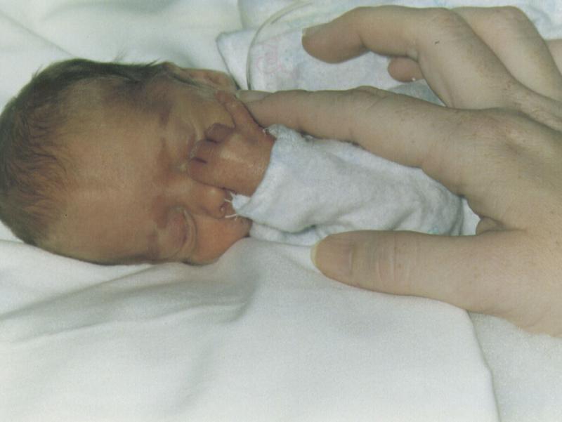 Amelia at one day old